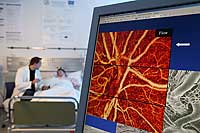 Engstellen und Veränderungen im Stromgebiet von Arterien erkennen