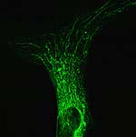 Mitochondriales Netzwerk