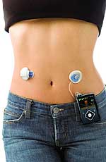 Insulinpumpensystem MiniMed 640G mit Sensor und Sender