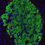 Fluoreszenzmikroskopie einer Langerhans-Insel