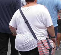 Risiko für Diabetes Typ 2 durch krankhaftes Übergewicht erhöht.