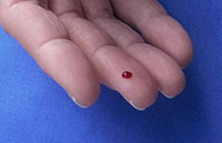 Ein Tropfen Blut kann nicht nur Blutzuckerwerte anzeigen.